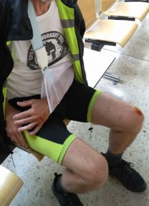 Verletzter Arm, mehrere Blutergüsse, aufgeschundenes Knie und Bein. Foto: Radlobby NÖ